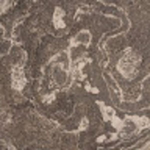 Meet your Posher, Matthias